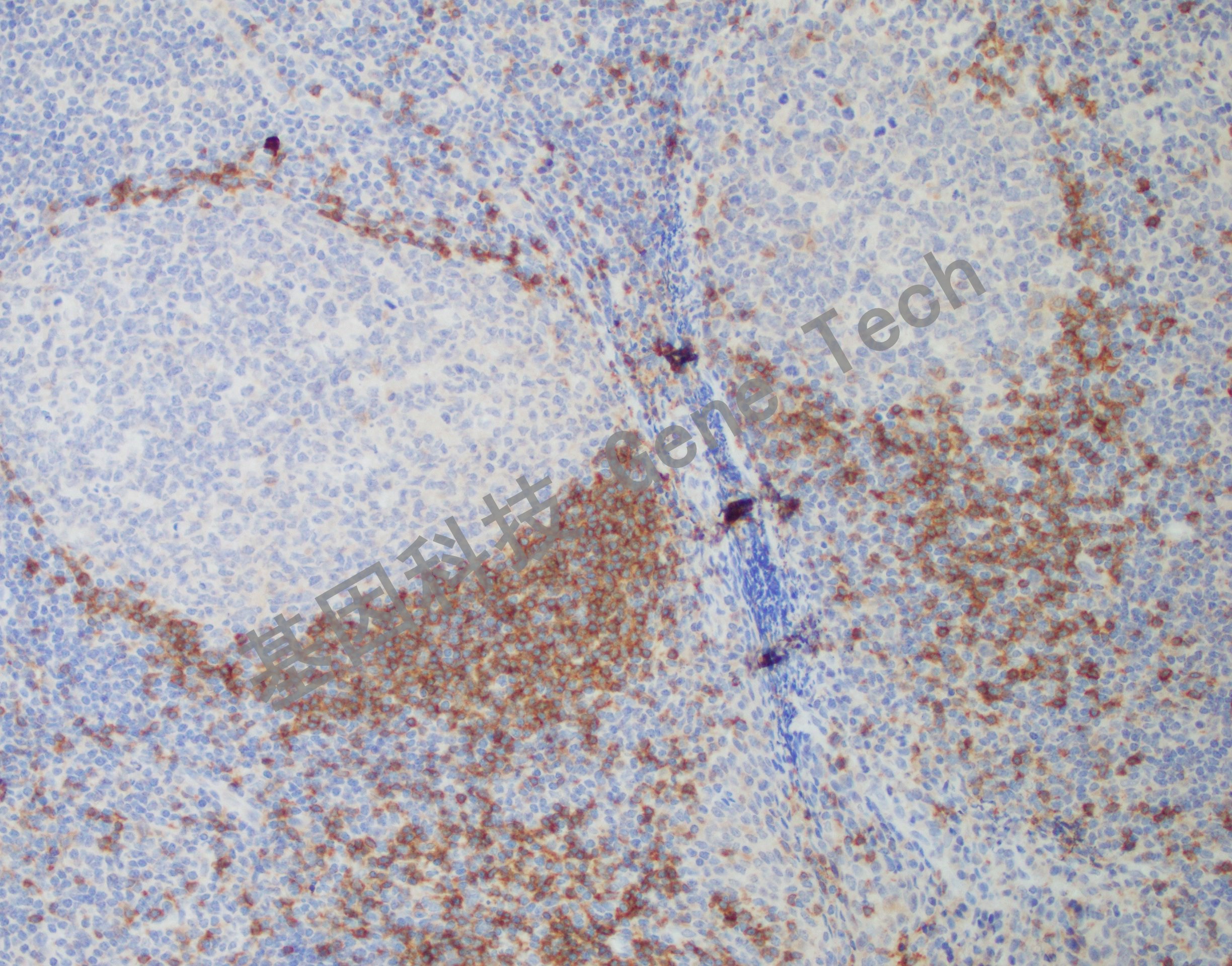 染色,细胞浆阳性,dab 显色