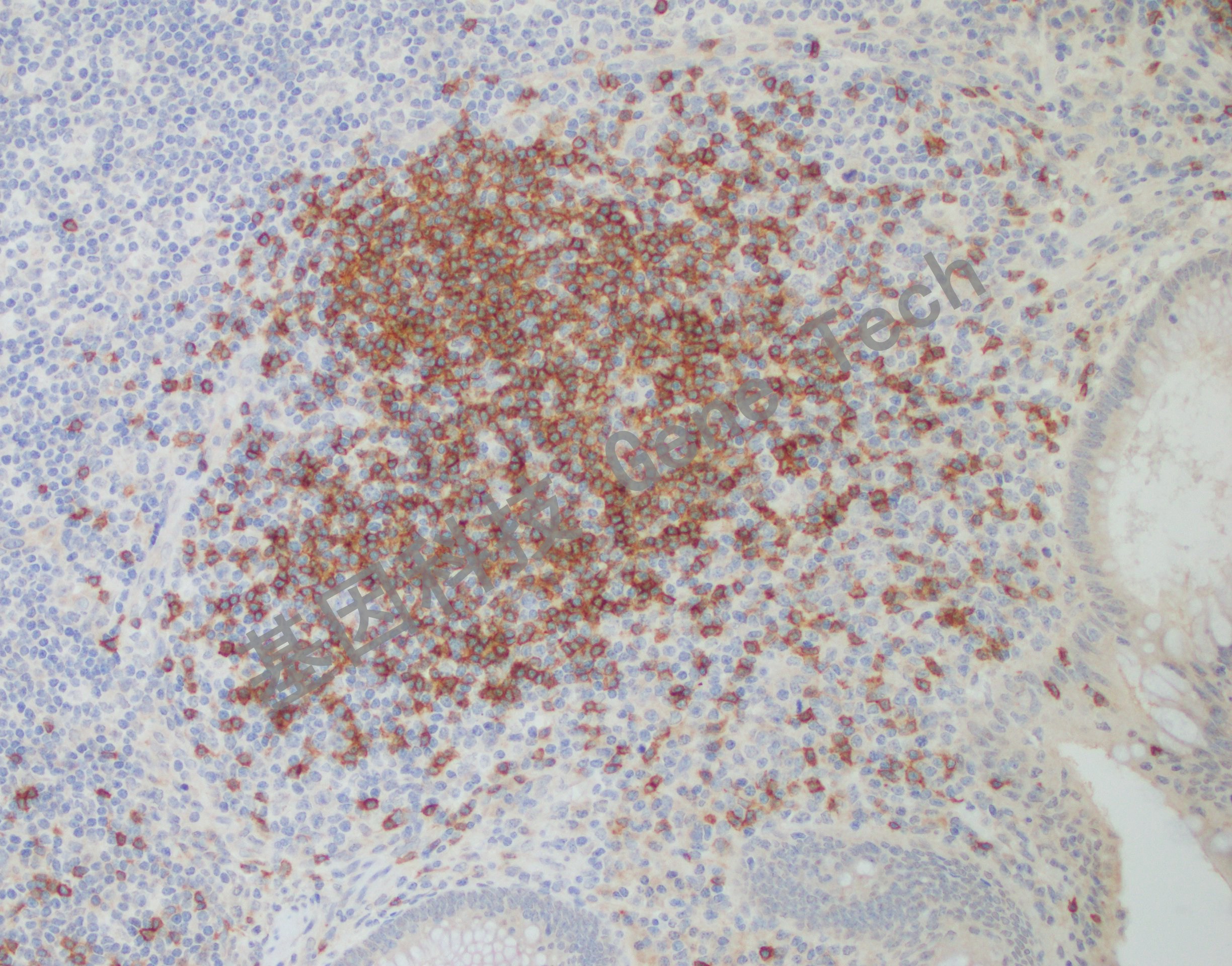 染色,细胞浆阳性,dab 显色