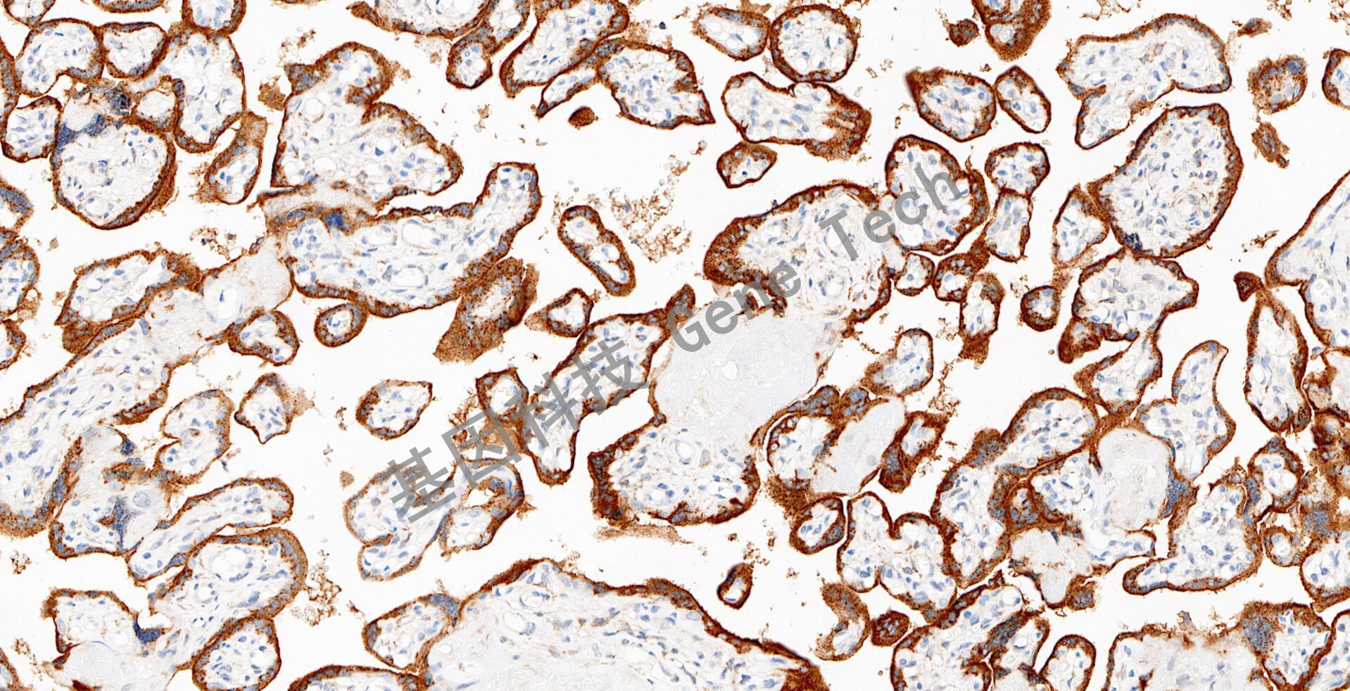 1684308511179179.jpg 20230330-29-Glypican-3-GT206802-BH15_20x胎盘_1_副本.jpg