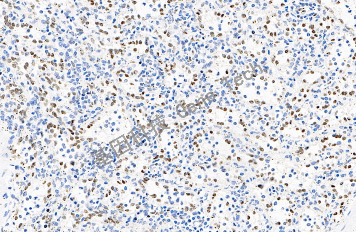 FLI-1 20倍 细胞核 脾脏_副本.jpg