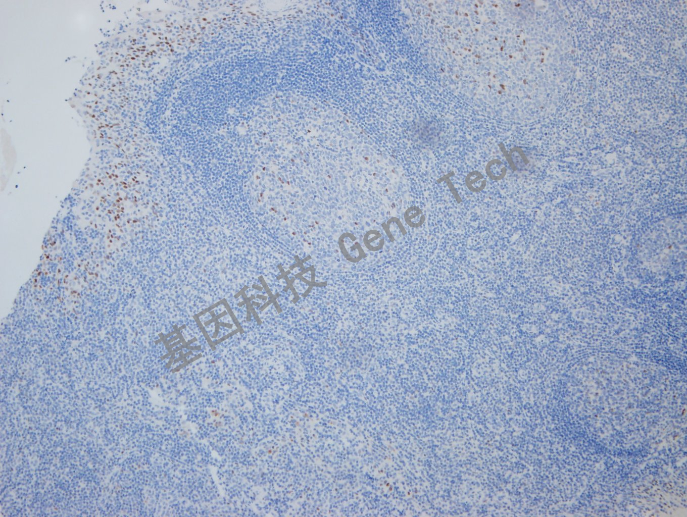 20190925G-9 nordiqc ER -1Tonsil -2_副本.jpg