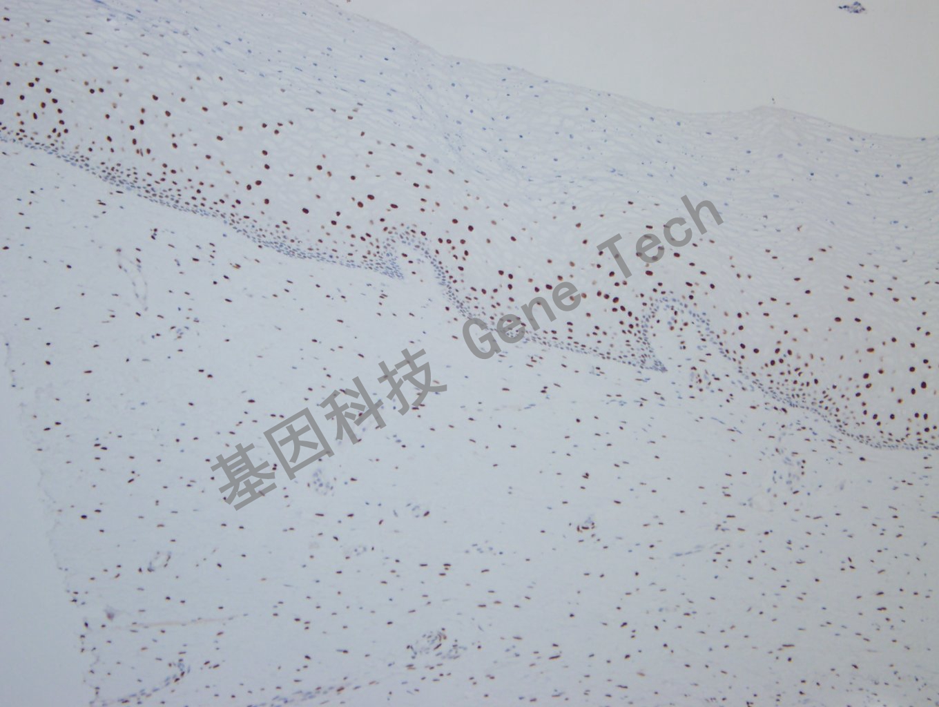 20190925G-9 nordiqc ER -2Uterine cervix -1_副本.jpg