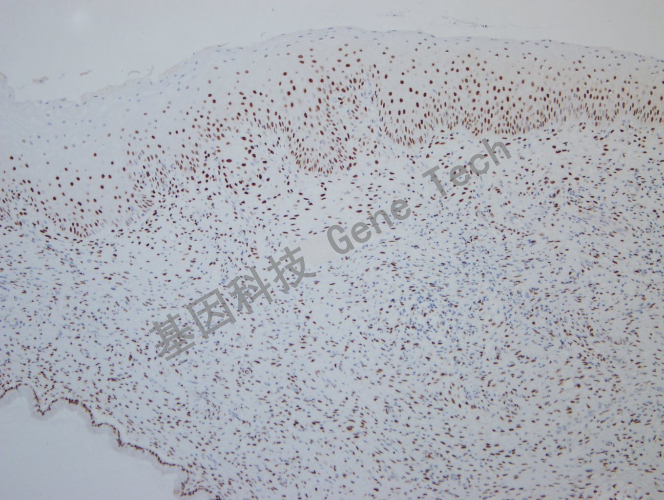 20190925G-9 nordiqc ER -2Uterine cervix -3_副本.jpg