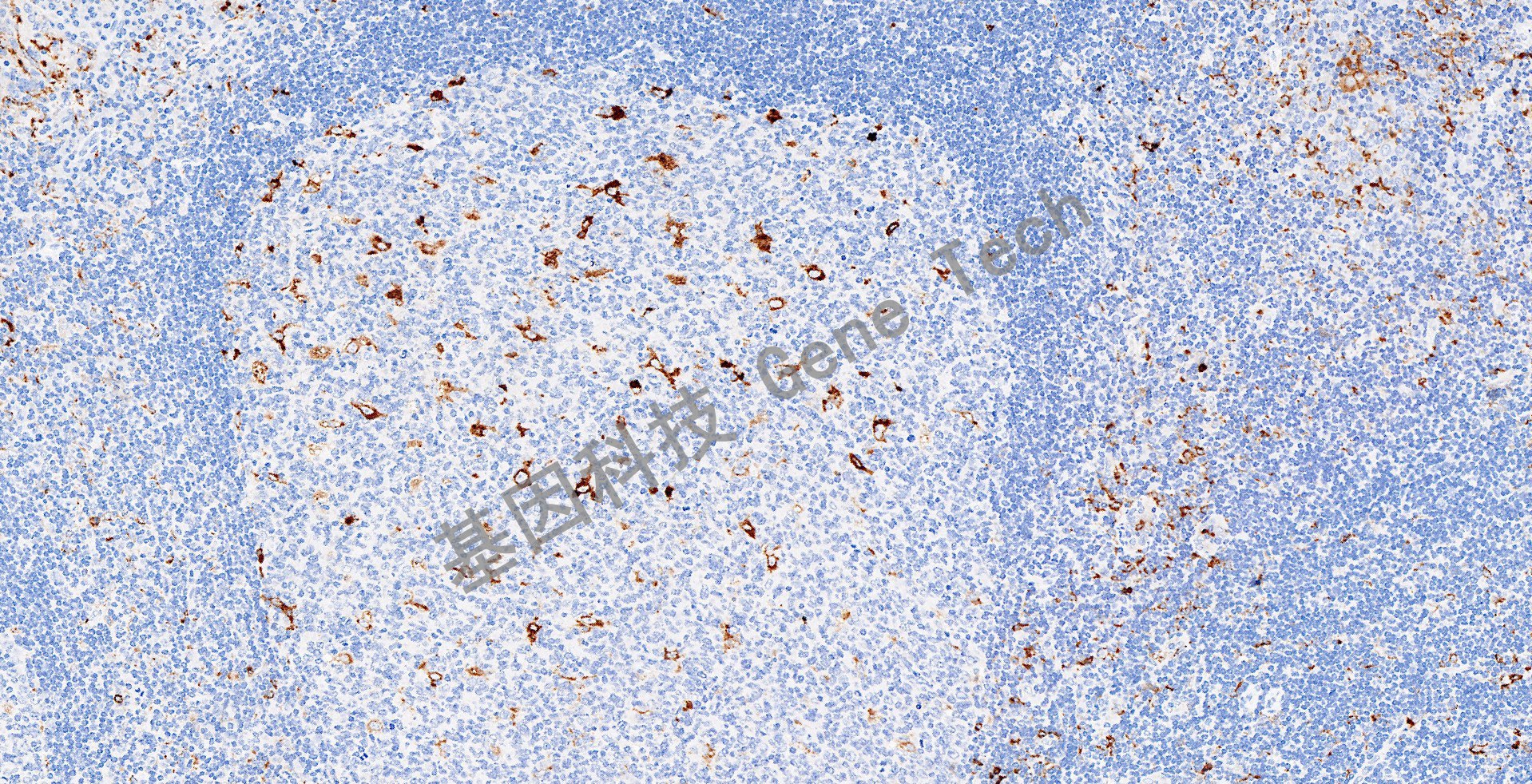 20230517-9-Lysozyme-GA009902-W70_15x 扁桃体_2_副本.jpg