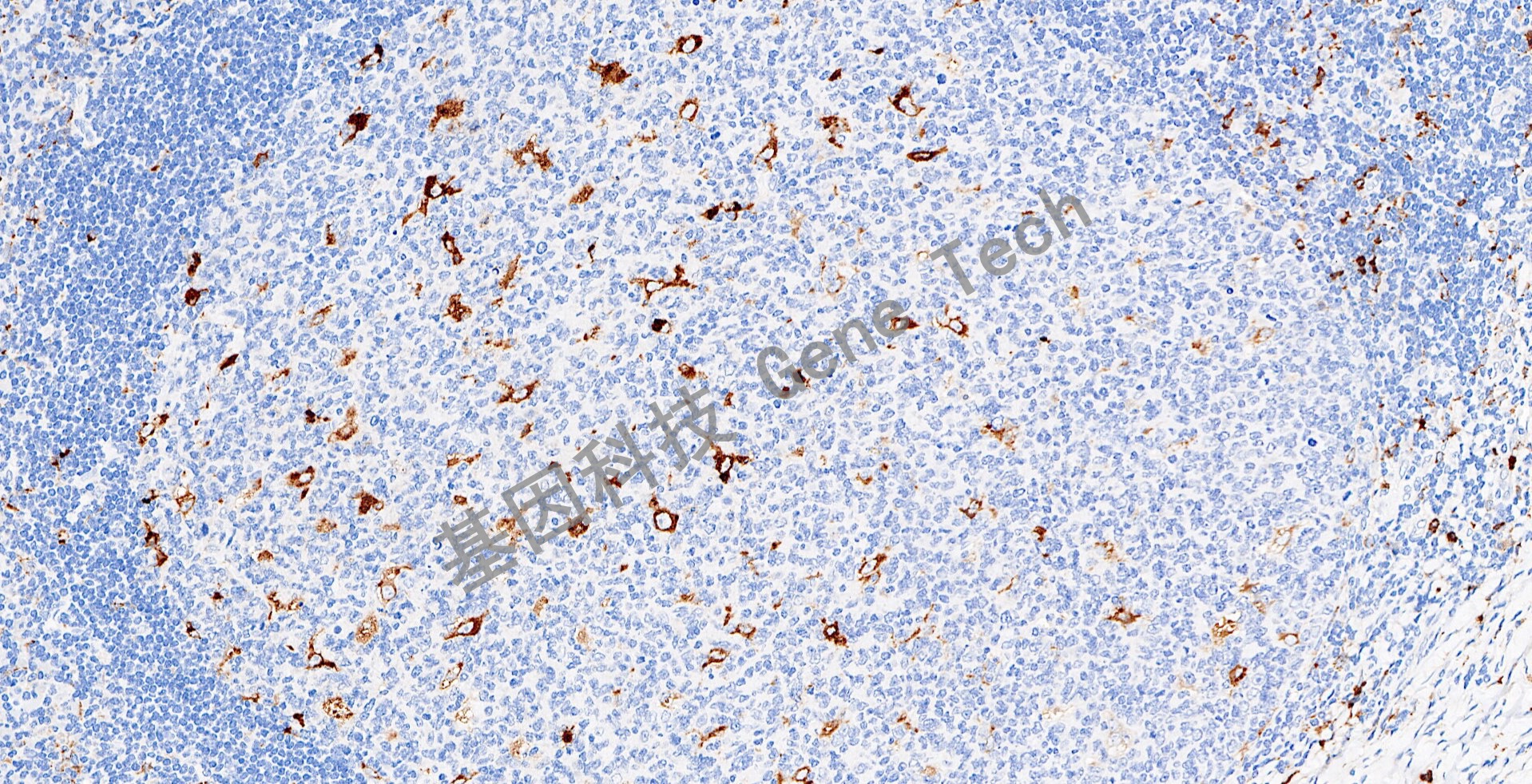 20230517-9-Lysozyme-GA009902-W70_20x 扁桃体_1_副本.jpg