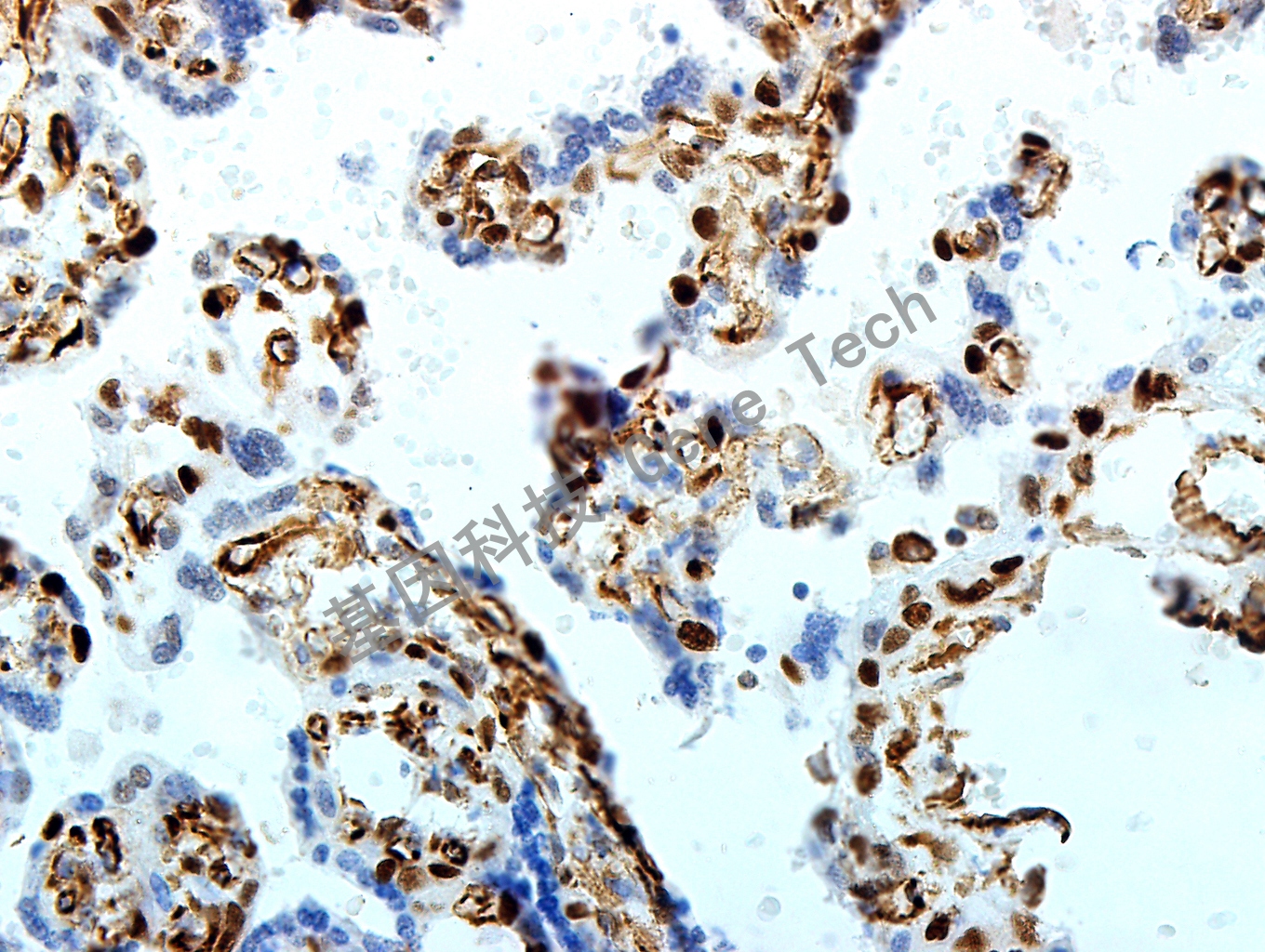 1690276349188702.jpg Cyclin E>2231-胎盘-40X_副本.jpg